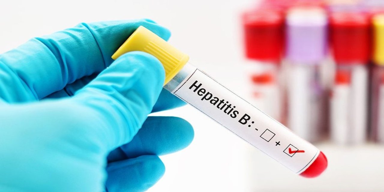 Türkiye’de Hepatit B virüsü taşıyan 3 milyon kişi var