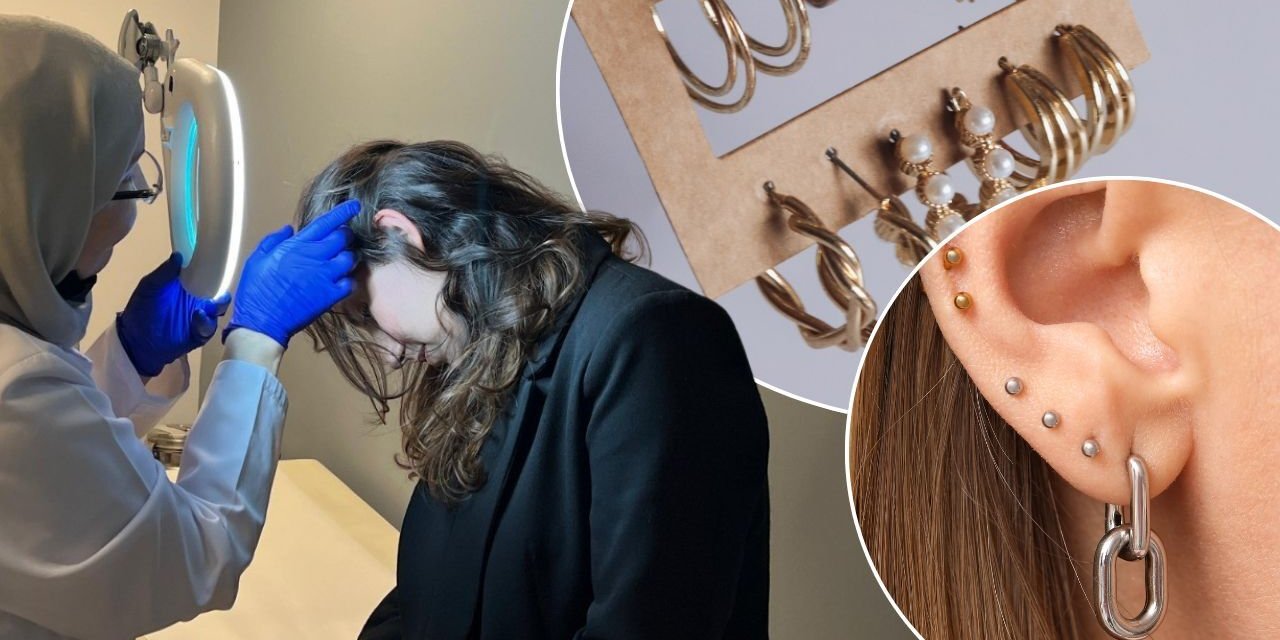 Metal küpeler, bileklikler, kolyeler gizli tetikleyici! Kaşıntıyla başlıyor, dikkat edilmezse hayat boyu devam ediyor