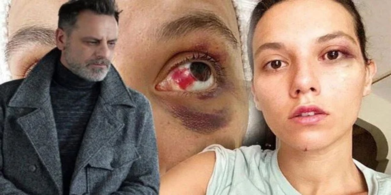 Ünlü sanatçıya hapis cezası