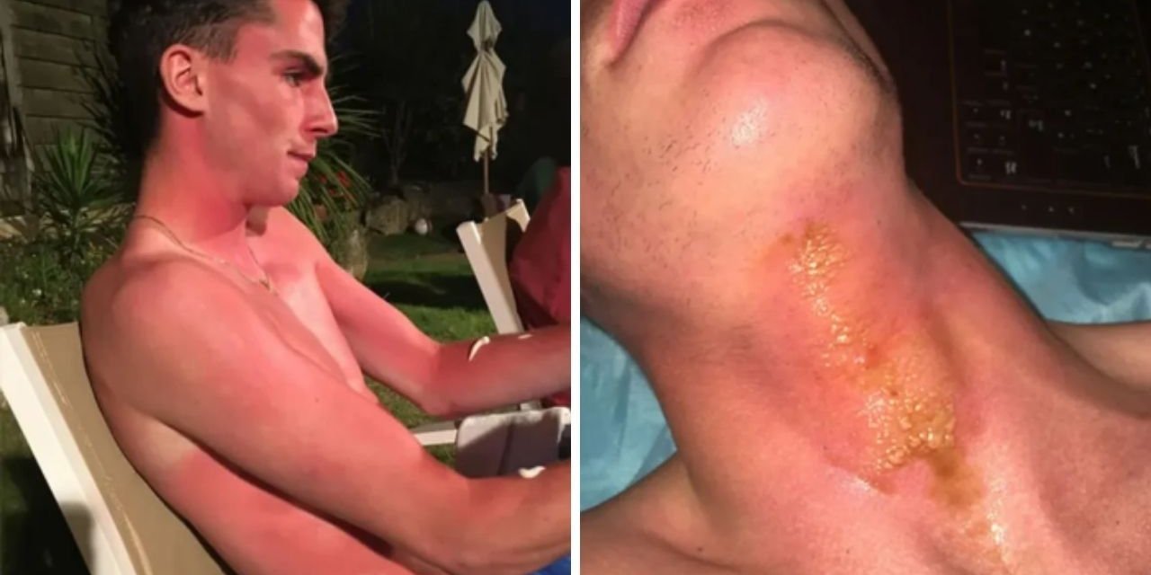 Altın kolye ile güneşlendi az daha boynu kopuyordu