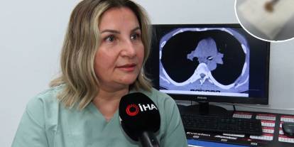 Uyurken dişlerini yuttu acil gittiği hastanede şok oldu