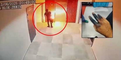 Az daha canından oluyordu: Elektrikli skuter patladı