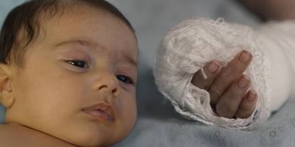 Hastanede skandal: 3 aylık bebeğin parmağını kopardı